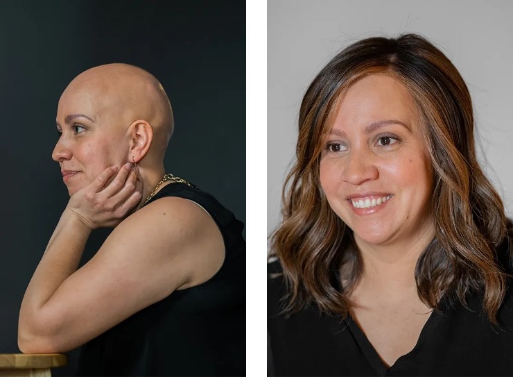 Celebrating Beauty and Resilience: A Journey Through an Empowering Alopecia Photoshoot Celebrating Beauty and Resilience: A Journey Through an Empowering Alopecia Photoshoot